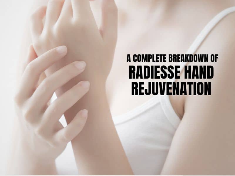 A Complete Breakdown of Radiesse Hand Rejuvenation