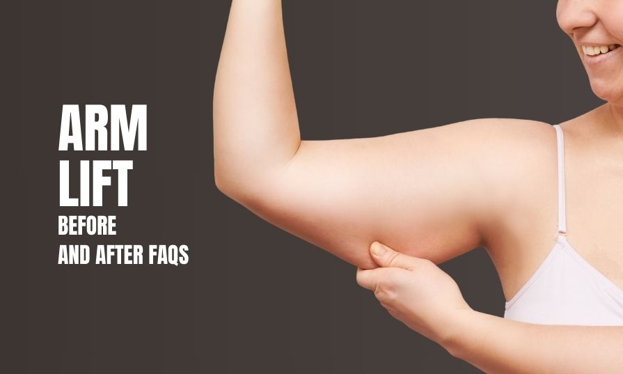 Arm Lift Before and After FAQs