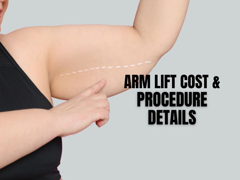 Arm Lift Cost & Procedure Details