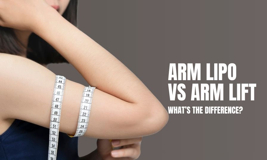 Arm Lipo vs Arm Lift What's the Difference