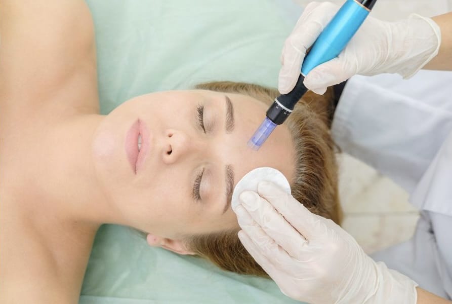 How Long To See Microneedling Results