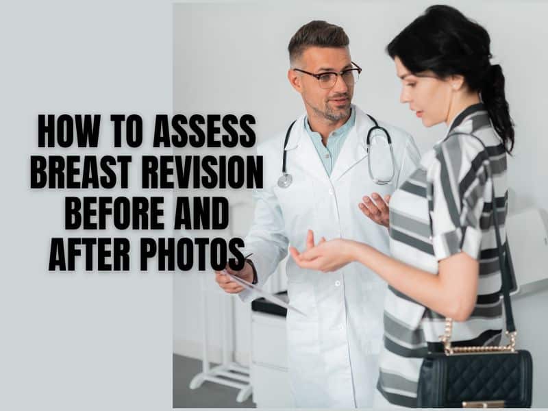 How to Assess Breast Revision Before and After Photos