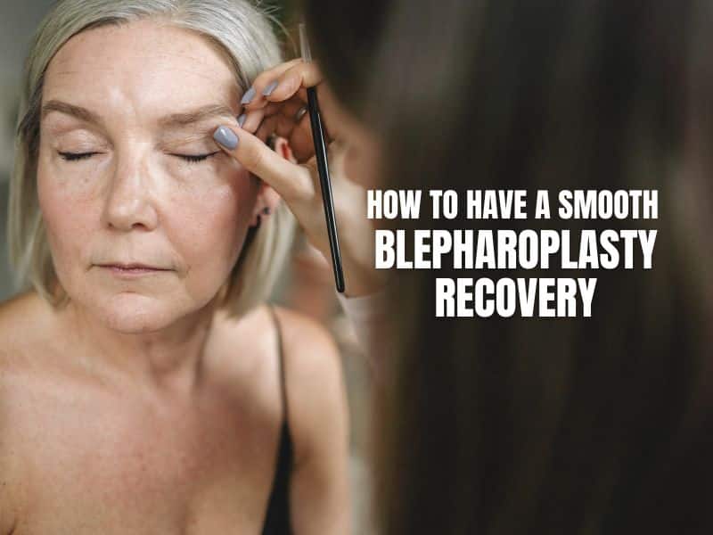 How to Have a Smooth Blepharoplasty Recovery