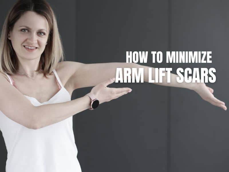 How to Minimize Arm Lift Scars