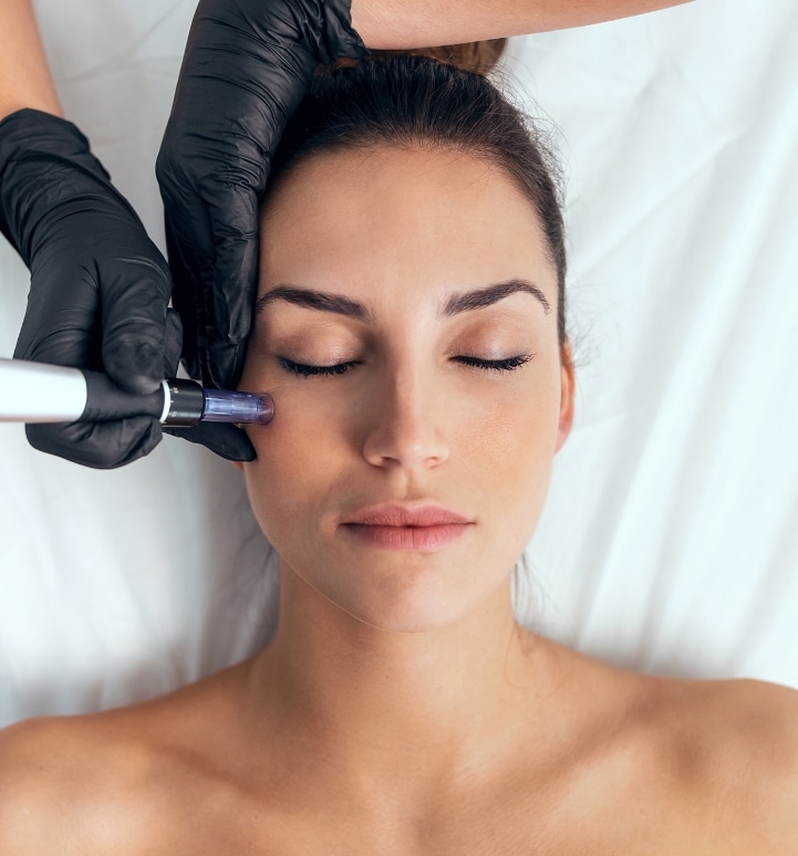 Microneedling and PRP Beverly Hills