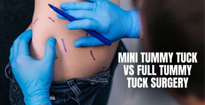 Mini Tummy Tuck vs Full Tummy Tuck Surgery
