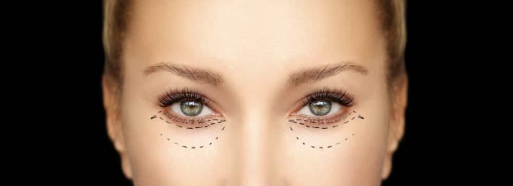 What Is Eyelid Surgery