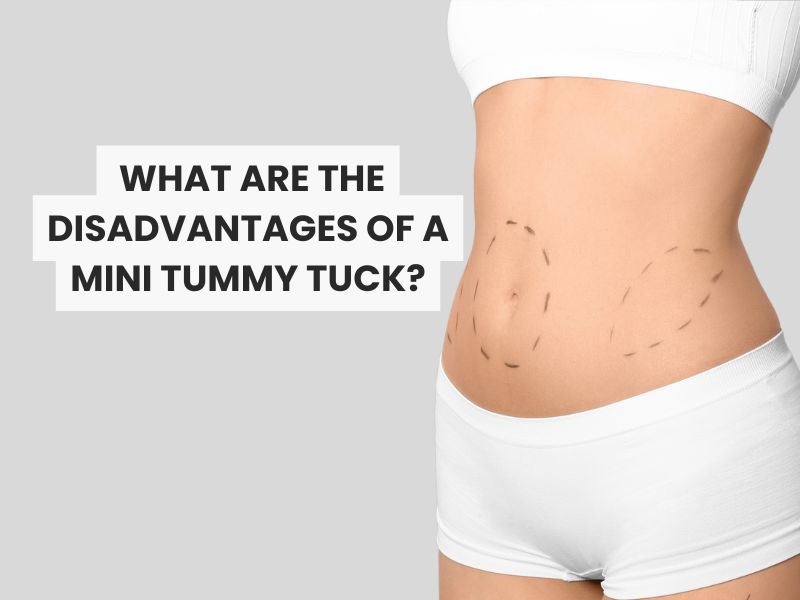 What are the disadvantages of a mini tummy tuck