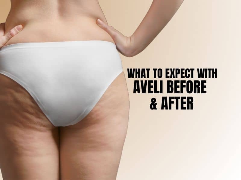 What to Expect with Avéli Before and After