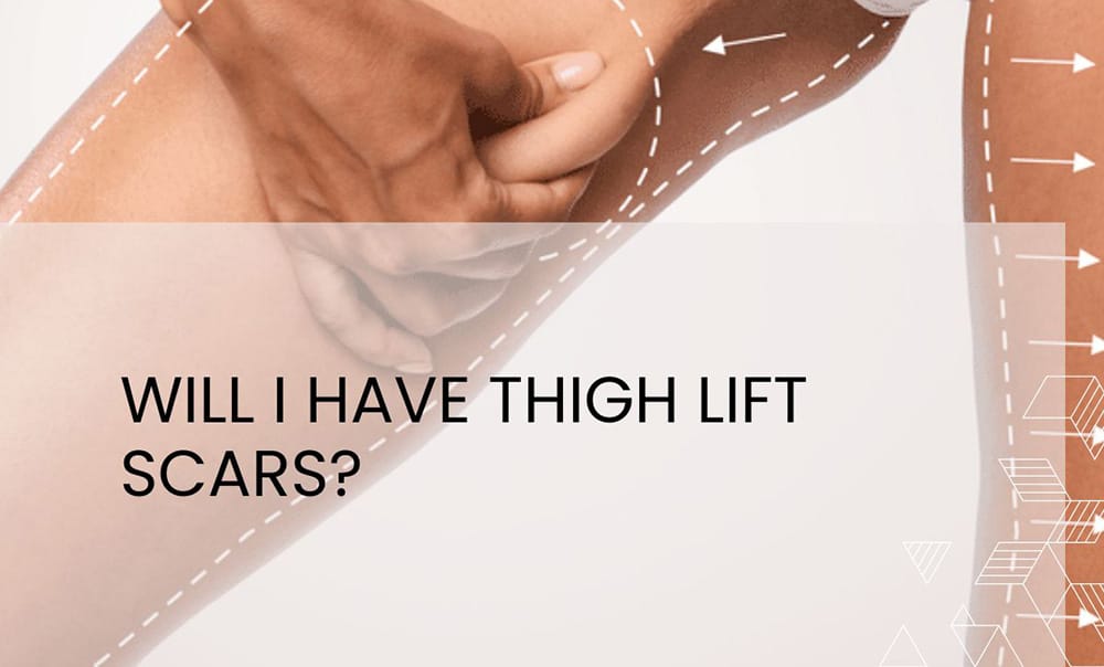 Will I Have Thigh Lift Scars