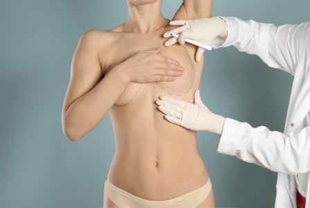 breast augmentation definition