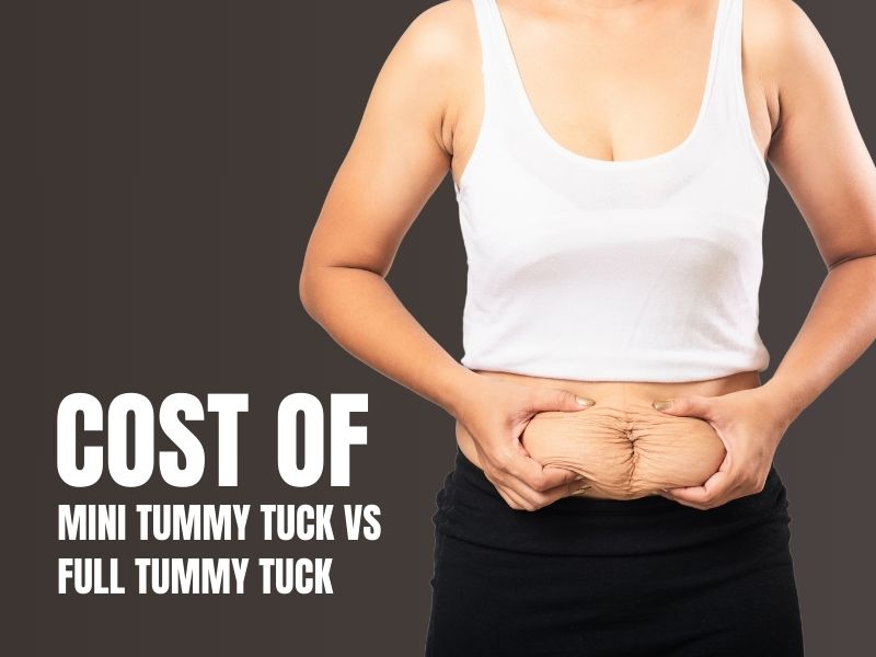 cost mini tummy tuck vs full tummy tuck