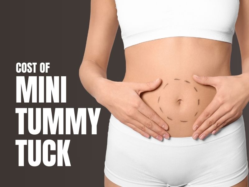 cost of mini tummy tuck