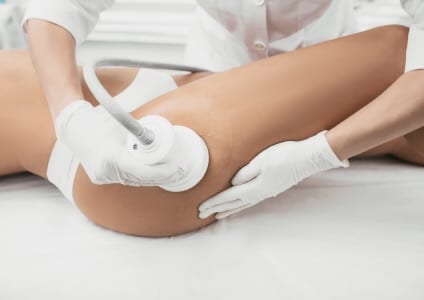 what is vaser liposuction procedure
