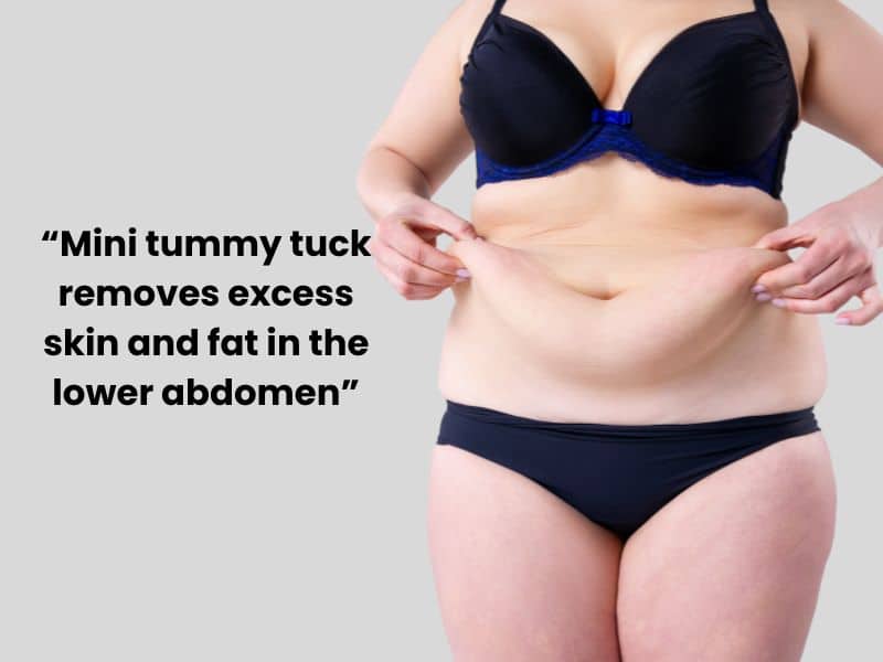 who is a good candidate for a mini tummy tuck